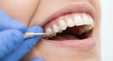 Aphten Lippe innen: Ursachen, Behandlung und Hausmittel - Arando Gesundheitsmagazin